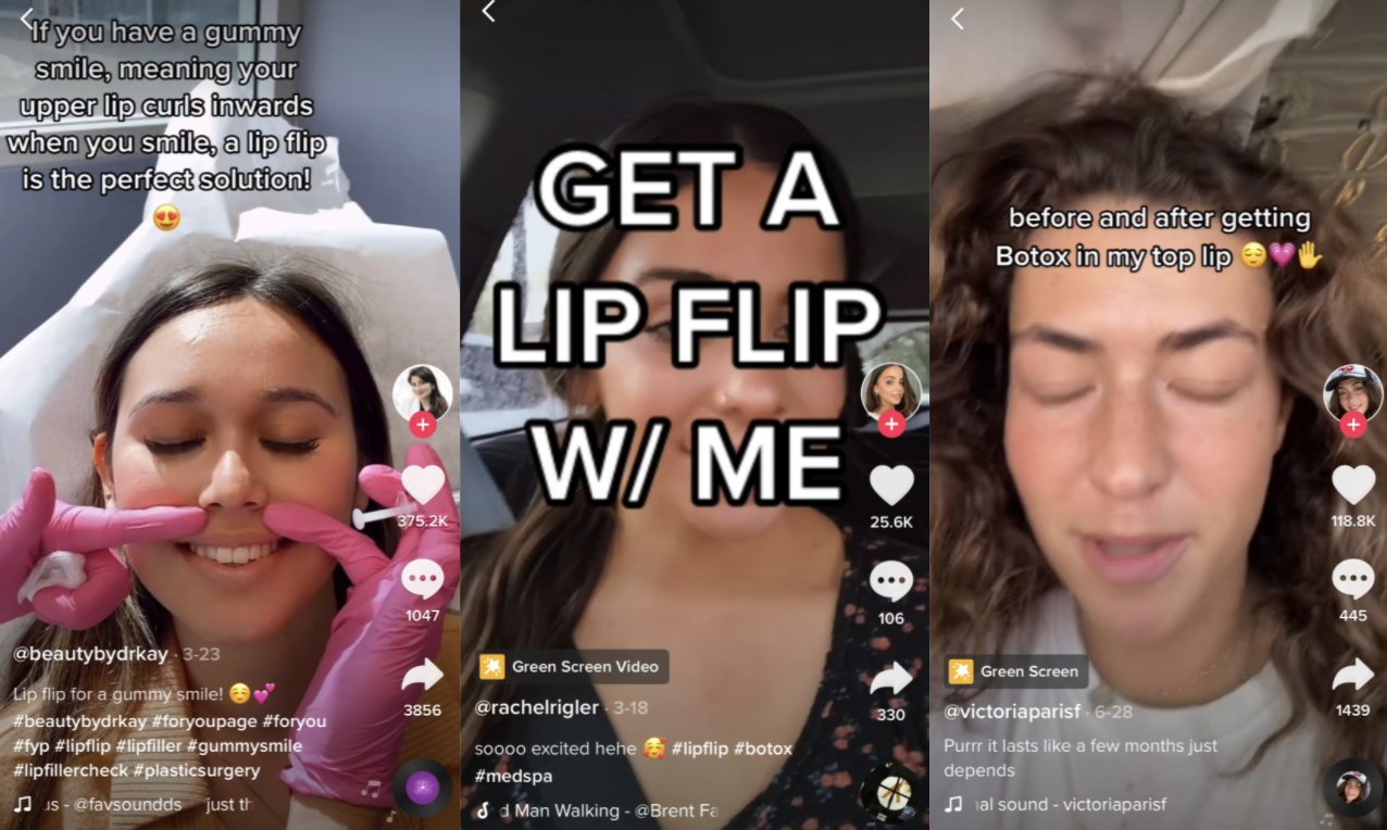 TikToks' cosmetic aesthetic obsession The lip flip