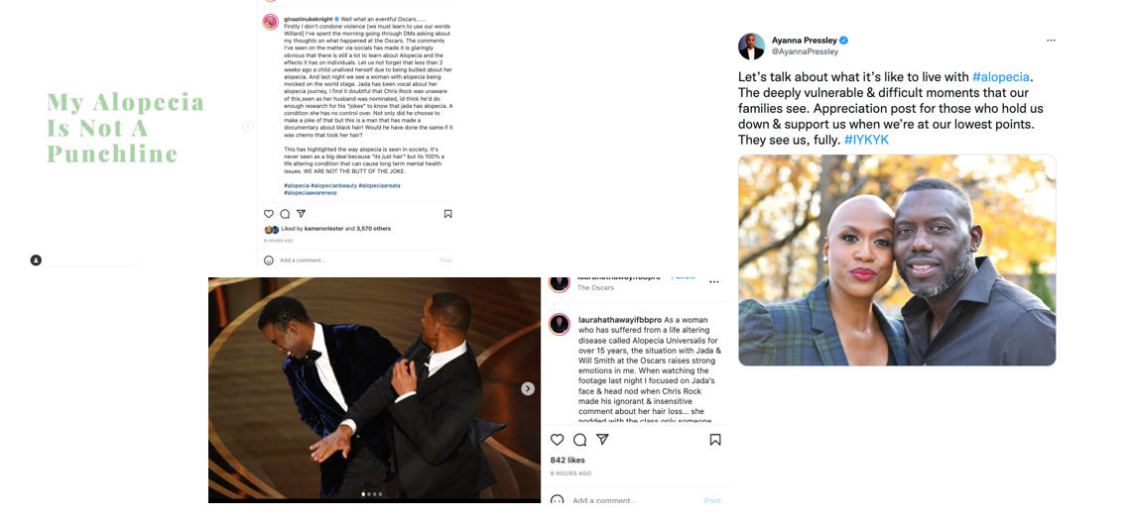 Alopecia advocates weigh in after Will Smith Oscars drama Alopecia advocates weigh in after Will Smith Oscars drama