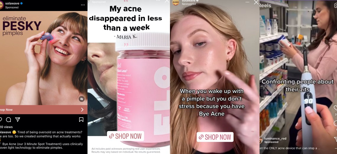 Goodbye ‘acne positivity’: TikTok and Instagram ads have some bold ...