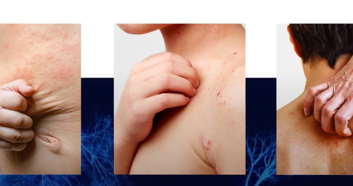 bpc 157 vial price bpc-157 injection site pain bpc 157 local injection Trigger Point Injections: How They Help with Stress & Tension Pain BPC-157 Size:30 ml is peptide bpc 157 __Methyl-Vitamin-B12-Liquid-Related-Blog